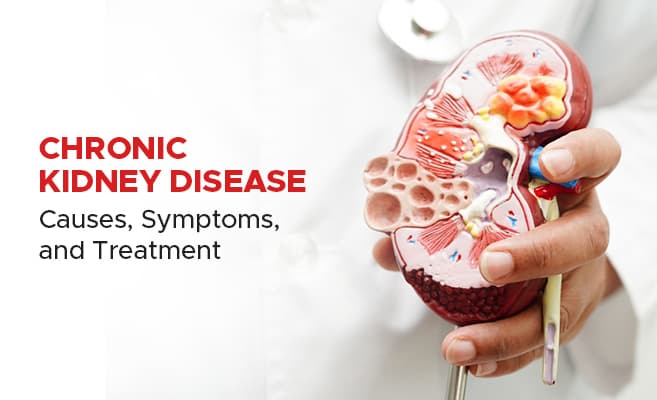 Chronic Kidney Disease (CKD) Management